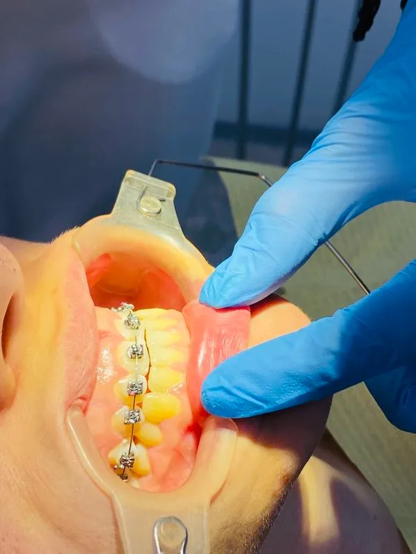 Фото Премиумдент 3