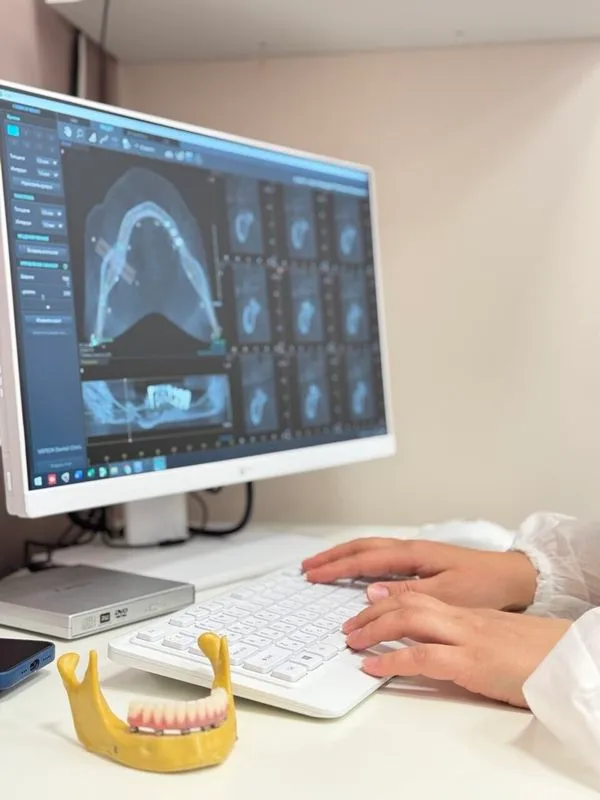 Фото SHEDO (ШЕДО) 4