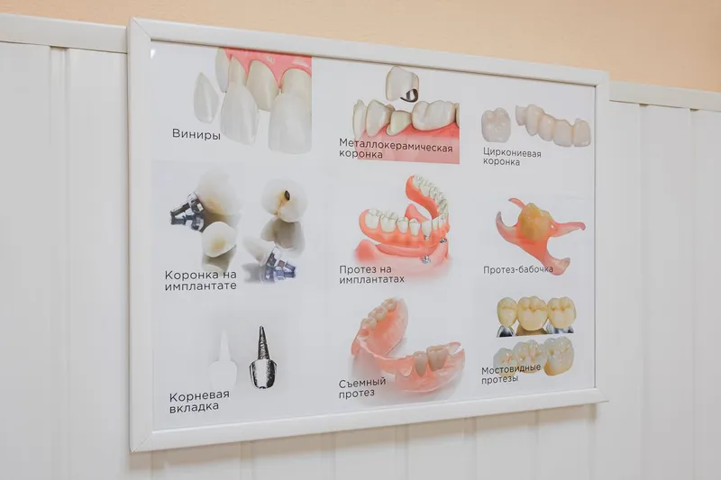 Фото СолДент 5